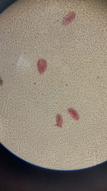 Paramecium W.M. Set Of 5 pcs. With Plastic Box - Image 4