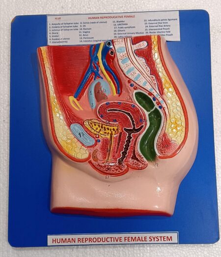 Human Reproductive System Female on Board 14 x 12" ( Superior)