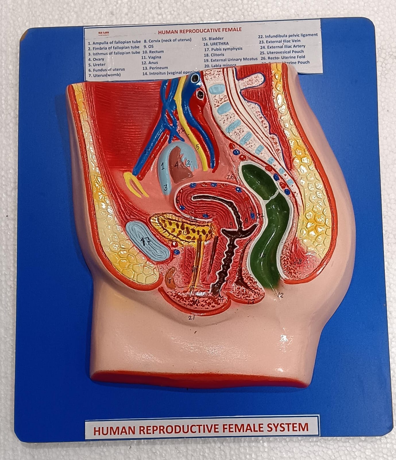 Human Reproductive System Female on Board 14 x 12" ( Superior)