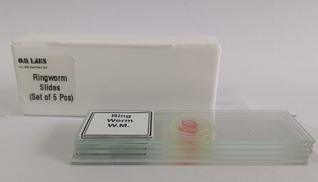 Ringworm Prepared Microscope Slide Set (Set Of 5Pcs.)